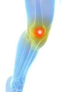Knee Pain Surgery NYC